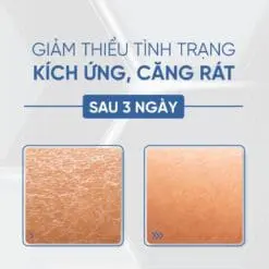 Tế bào gốc cấp ẩm căng bóng Desembre H+ Hộp 10 lọ 10 23 Cap am phuc hoi cho da ton thuong 2