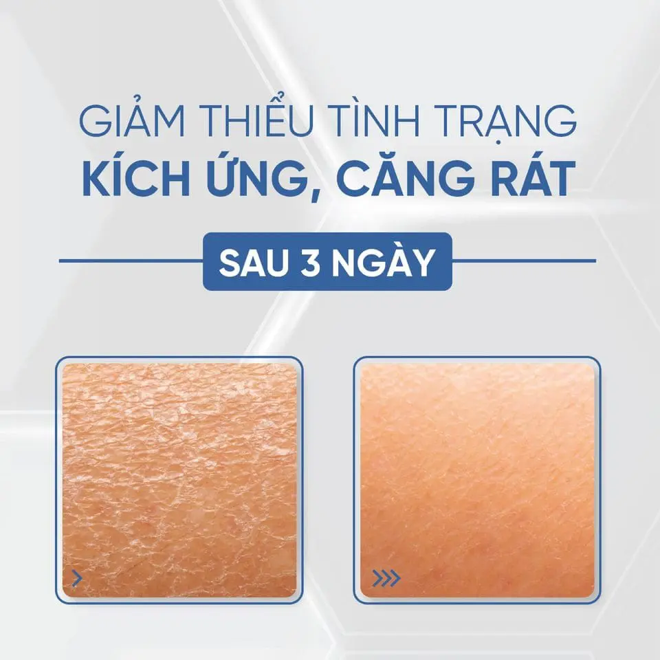 Tế bào gốc cấp ẩm căng bóng Desembre H+ Hộp 10 lọ 4 Tế bào gốc cấp ẩm căng bóng Desembre H+ Hộp 10 lọ - Ảnh 4