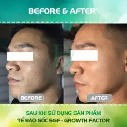Alternative view of Tế bào gốc 5GF Dr Pluscell Growth Factor