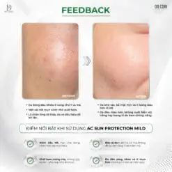 Kem Chống Nắng Dr Pluscell kiềm dầu mỏng nhẹ AC Sun Protection Mild 50ml 9 548629462 1104836055095886 1728150612924795661 n