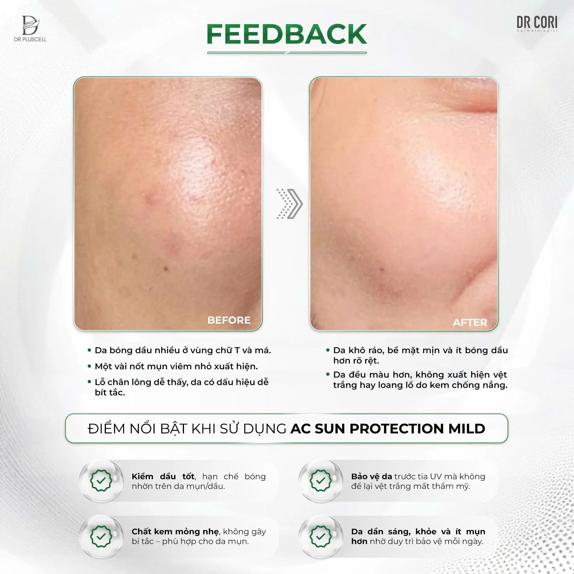 Kem Chống Nắng Dr Pluscell kiềm dầu mỏng nhẹ AC Sun Protection Mild 50ml 5 Kem Chống Nắng Dr Pluscell kiềm dầu mỏng nhẹ AC Sun Protection Mild 50ml - Ảnh 5