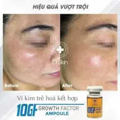 Alternative view of Tế bào gốc 10GF IDR Skin Growth factor ampoule lẻ lọ 8ml