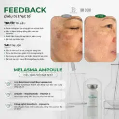 Alternative view of Ampoule Trị Nám DR Melasma DR CORI LẺ LỌ 8ML (HỘP 10 LỌ)