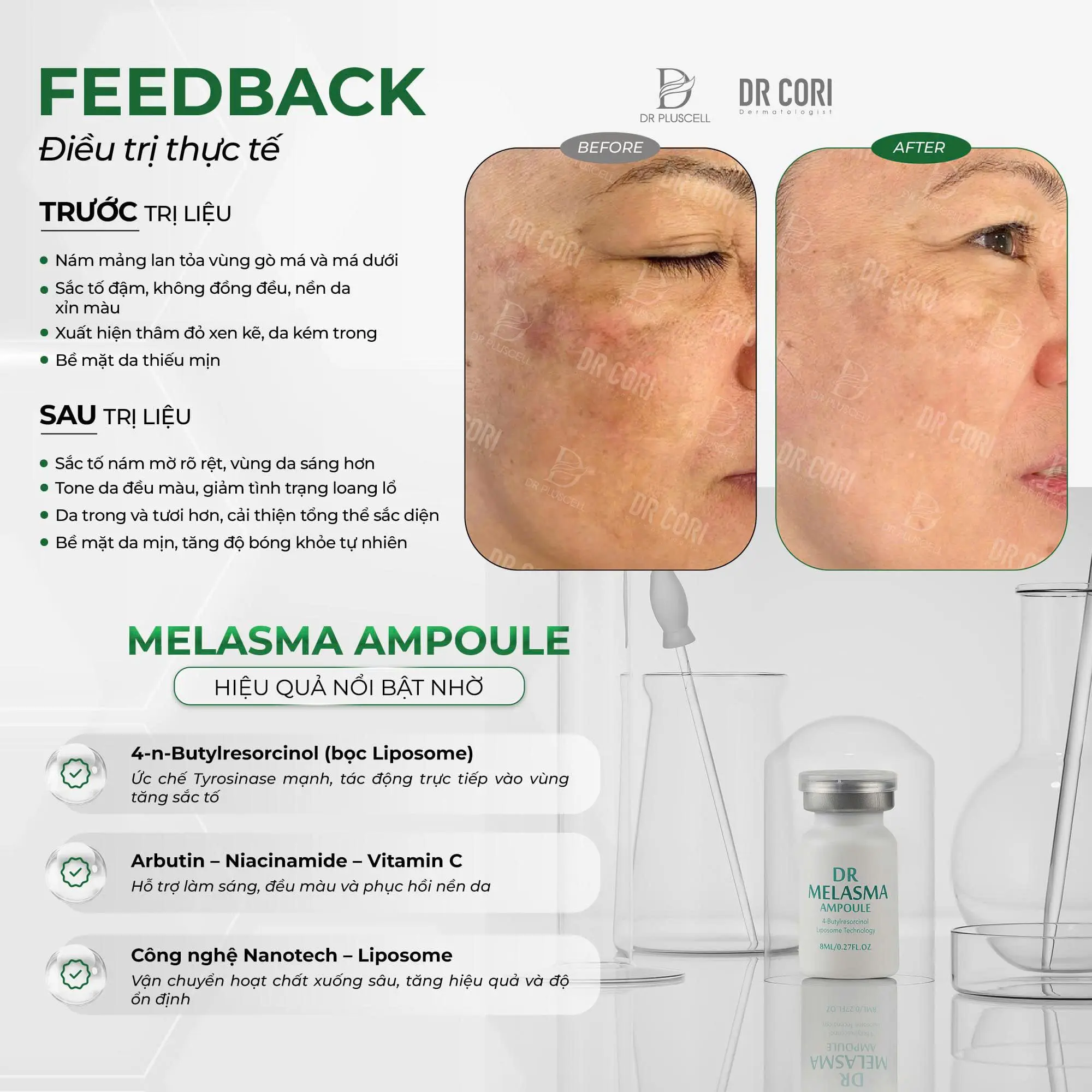 Ampoule Trị Nám DR Melasma DR CORI LẺ LỌ 8ML (HỘP 10 LỌ) 2 Ampoule Trị Nám DR Melasma DR CORI LẺ LỌ 8ML (HỘP 10 LỌ) - Ảnh 2