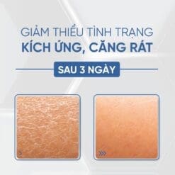 Tế bào gốc cấp ẩm căng bóng Desembre H+ Hộp 10 lọ 10 23 Cap am phuc hoi cho da ton thuong 2