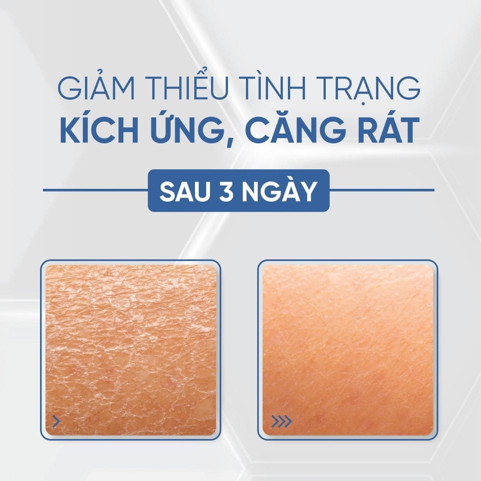 Tế bào gốc cấp ẩm căng bóng Desembre H+ Hộp 10 lọ 4 Tế bào gốc cấp ẩm căng bóng Desembre H+ Hộp 10 lọ - Ảnh 4