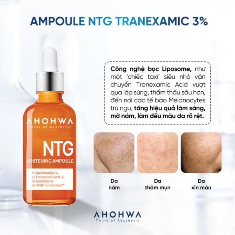 Serum Trị Nám Ahohwa NTG Whitening Ampoule 50ml 5 Serum Trị Nám Ahohwa NTG Whitening Ampoule 50ml - Ảnh 5
