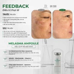 Alternative view of Ampoule Trị Nám DR Melasma DR CORI LẺ LỌ 8ML (HỘP 10 LỌ)