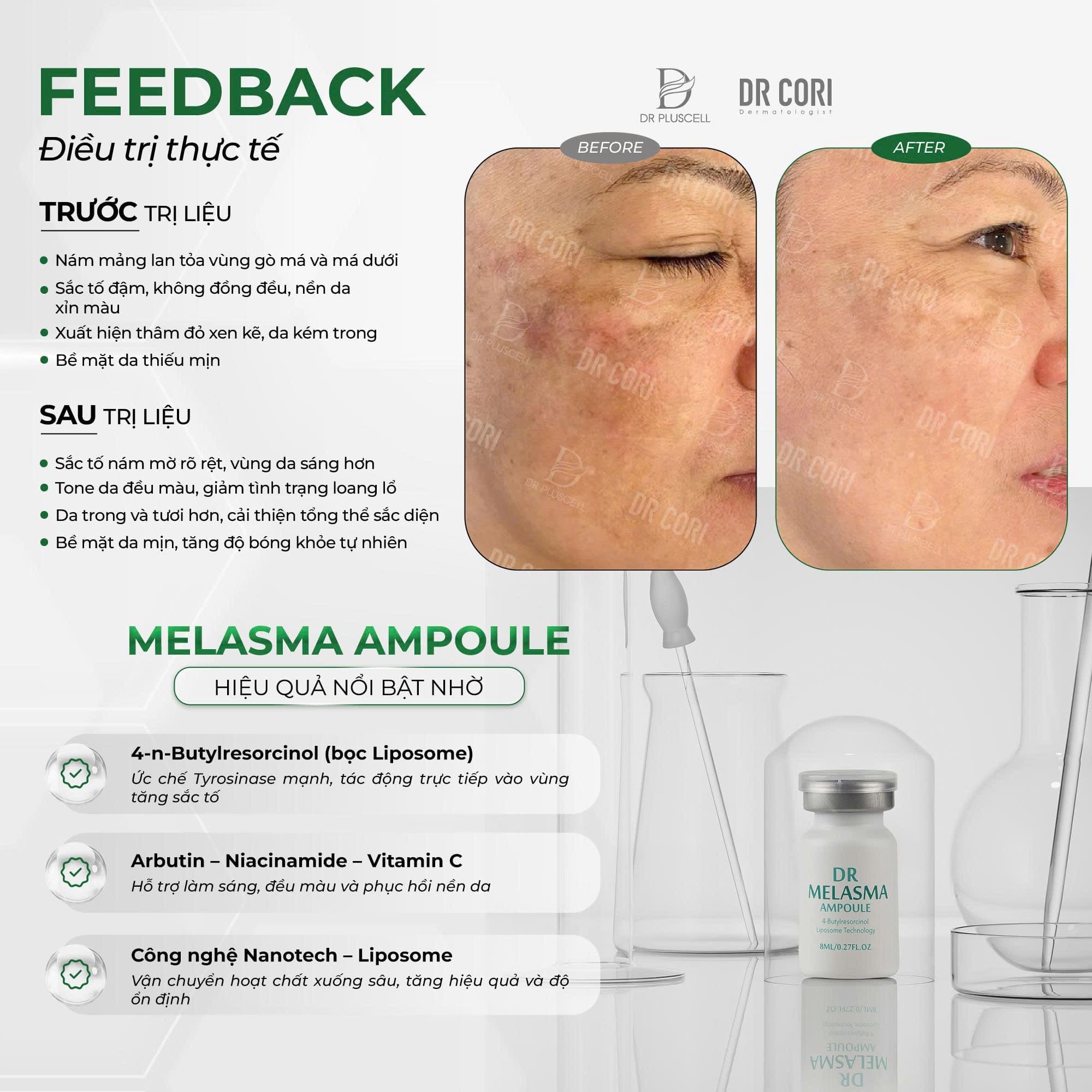 Ampoule Trị Nám DR Melasma DR CORI LẺ LỌ 8ML (HỘP 10 LỌ) 2 Ampoule Trị Nám DR Melasma DR CORI LẺ LỌ 8ML (HỘP 10 LỌ) - Ảnh 2